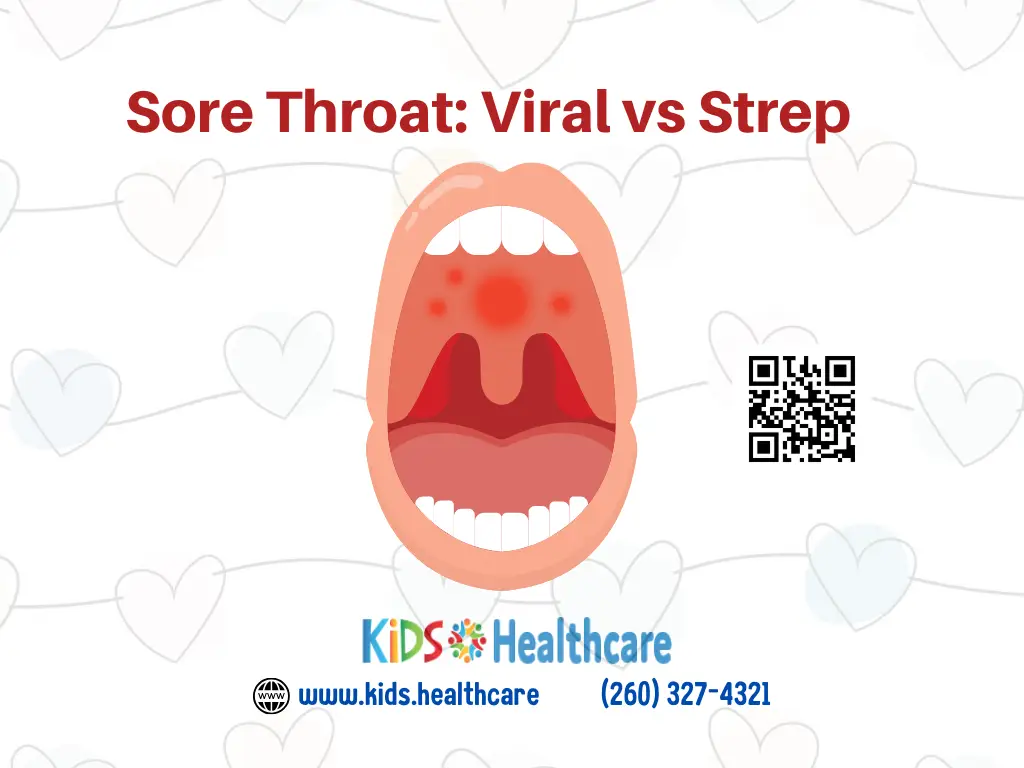 Sore Throat: Strep Vs Viral